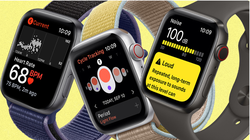 Các nhà nghiên cứu nhận thấy Apple Watch có khả năng phát hiện các bệnh về rối loạn tinh thần (Ảnh: Gizmochina)