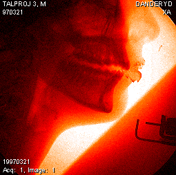 Ảnh: BrightSide Ảnh: BrightSide