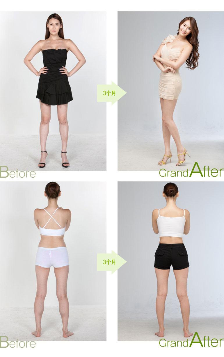 Quảng cáo về hiệu quả của thủ thuật Phong tỏa bắp chân sau 3 tháng (Ảnh: Sohu). Quảng cáo về hiệu quả của thủ thuật Phong tỏa bắp chân sau 3 tháng (Ảnh: Sohu).