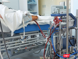 Bệnh nhân 91 phi công người Anh đang phụ thuộc hoàn toàn vào kỹ thuật ECMO (tim phổi nhân tạo) - Ảnh: SYT