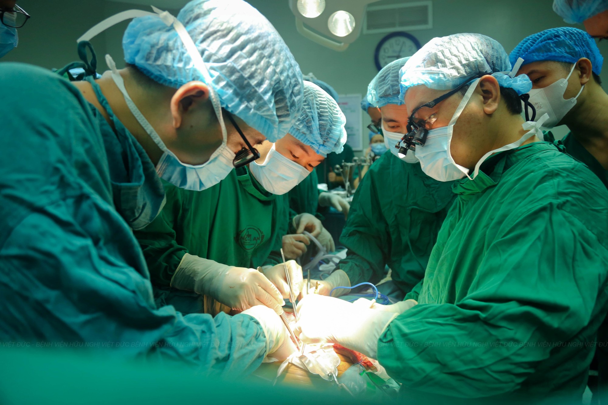 3- Phẫu thuật lấy tạng tại BV HN ĐK Nghệ An.JPG