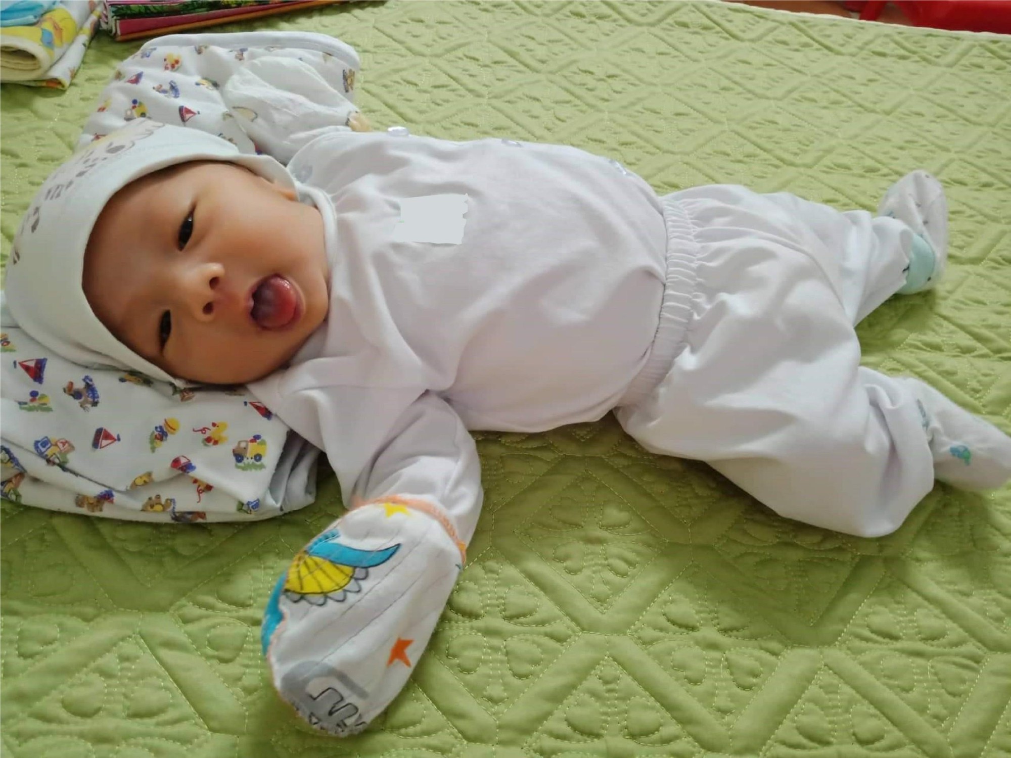 Bé Đậu Xanh chào đời nặng 3.8kg bằng phương pháp sinh mổ (Ảnh - BVCC)