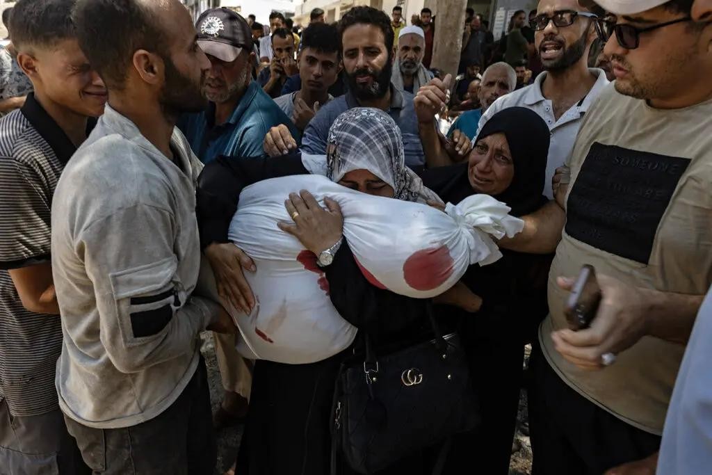 Cái chết thầm lặng ở Gaza Nạn đói, suy dinh dưỡng và sự tuyệt vọng 3.jpg