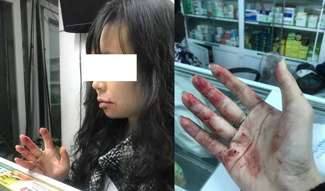 Cập nhật: Uber phản hồi vụ tài xế đánh khách chảy máu - ảnh 1