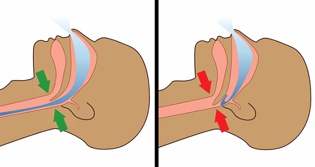 7 nguyên nhân khiến nhiều người không thể ngủ lại sau khi tỉnh dậy vào lúc nửa đêm - ảnh 3