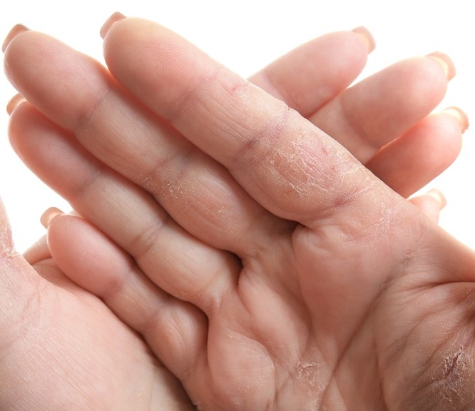 9 thay đổi cơ thể hết sức bình thường nhưng lại ẩn chứa nguy hiểm chết người - ảnh 7