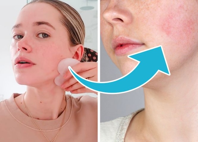 7 sản phẩm chăm sóc da có tác dụng phụ bạn nên chú ý ảnh 3