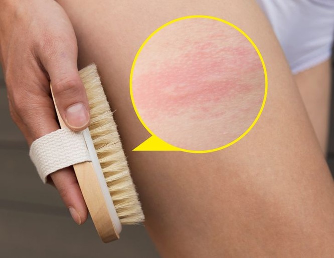 7 sản phẩm chăm sóc da có tác dụng phụ bạn nên chú ý ảnh 4