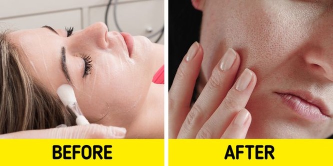 7 sản phẩm chăm sóc da có tác dụng phụ bạn nên chú ý ảnh 6