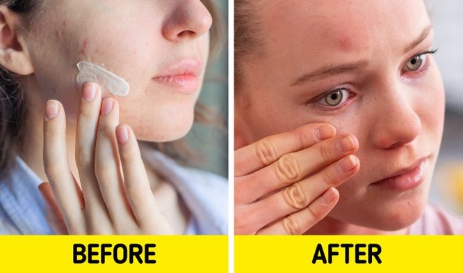 7 sản phẩm chăm sóc da có tác dụng phụ bạn nên chú ý ảnh 2