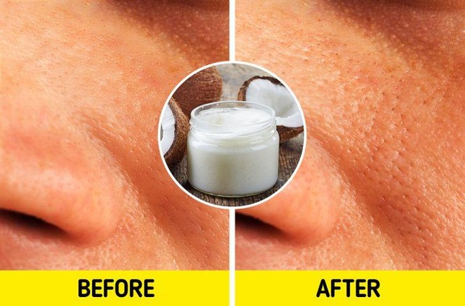 7 sai lầm tai hại khiến làn da phải “kêu cứu” ảnh 4