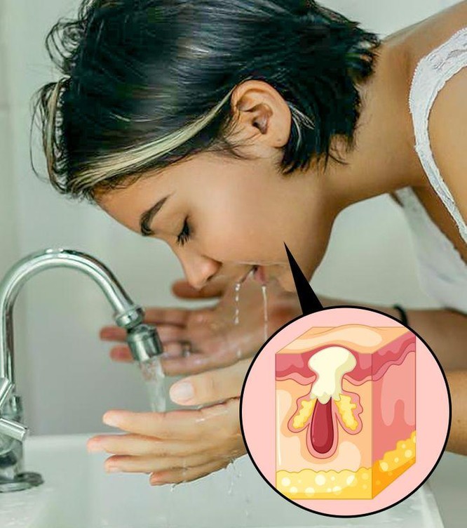 7 sai lầm tai hại khiến làn da phải “kêu cứu” ảnh 5