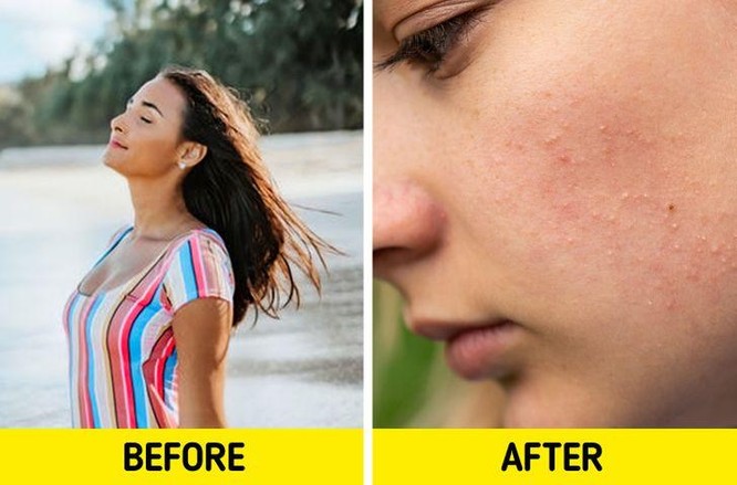 7 sai lầm tai hại khiến làn da phải “kêu cứu” ảnh 3