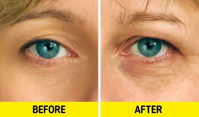 7 sai lầm tai hại khiến làn da phải “kêu cứu” ảnh 1