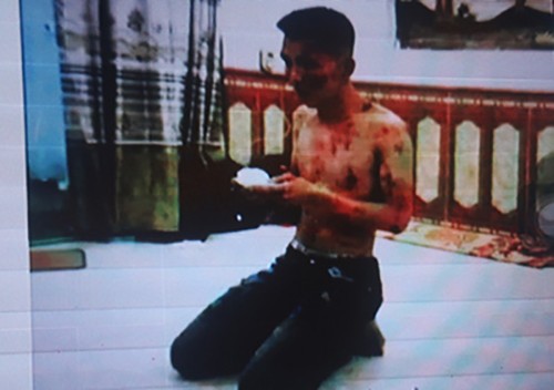 Một nạn nhân bị tra tấn tại công ty tài chính Nam Long. Ảnh: Công an cung cấp.