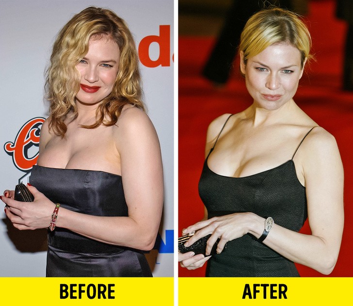 12 công dụng tuyệt vời cho cơ thể nếu bạn dùng dầu cá mỗi ngày ảnh 11 12 công dụng tuyệt vời cho cơ thể nếu bạn dùng dầu cá mỗi ngày ảnh 11