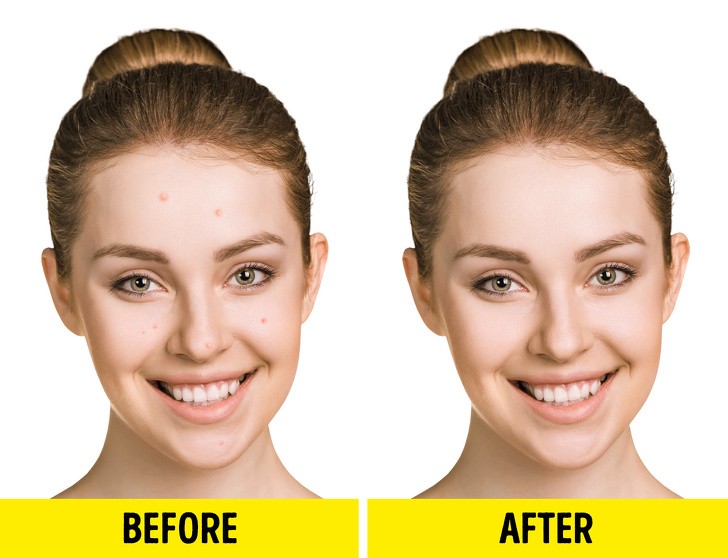 12 công dụng tuyệt vời cho cơ thể nếu bạn dùng dầu cá mỗi ngày ảnh 10 12 công dụng tuyệt vời cho cơ thể nếu bạn dùng dầu cá mỗi ngày ảnh 10