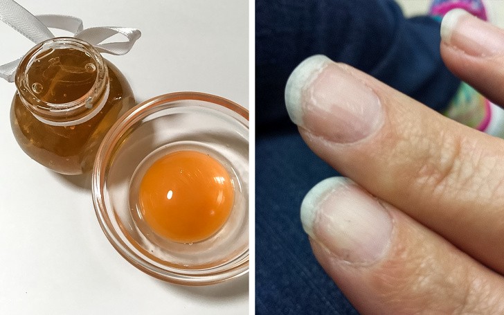 10 liệu pháp tự nhiên đối phó với móng tay yếu, dễ gãy  ảnh 7 10 liệu pháp tự nhiên đối phó với móng tay yếu, dễ gãy  ảnh 7