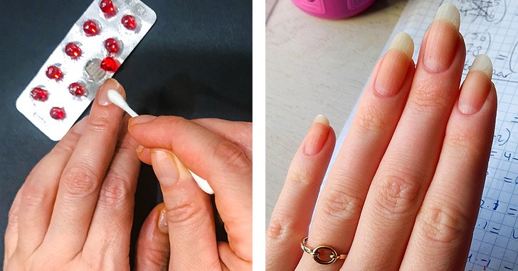 10 liệu pháp tự nhiên đối phó với móng tay yếu, dễ gãy  ảnh 1 10 liệu pháp tự nhiên đối phó với móng tay yếu, dễ gãy  ảnh 1