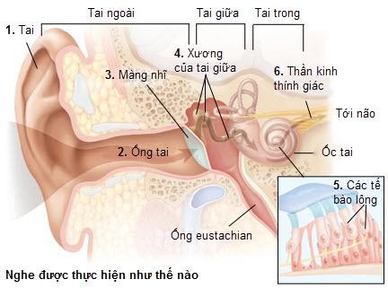 Ảnh: Phonak Việt Nam