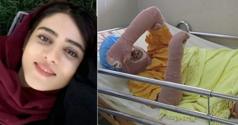“Blue girl” Sahar Khodayari giả trai vào sân vận động để xem bóng đá bị bắt và đã tự thiêu cạnh tòa án. Ảnh: Sahar Khodayari và trên giường bệnh viện trước khi qua đời.