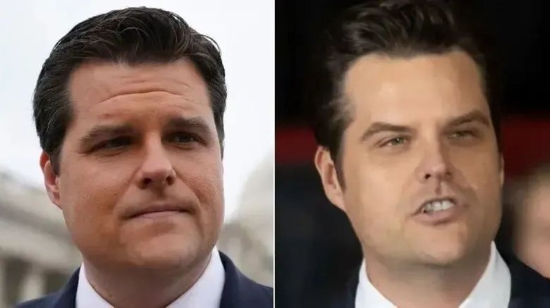Cựu dân biểu đảng Cộng hòa Matt Gaetz thay đổi gương mặt. Ảnh: 6park. Matt Gaetz.jpg