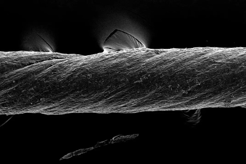 Chỉ khâu y tế "thông minh" không tế bào "De-gut". Ảnh minh họa Scitech Daily.