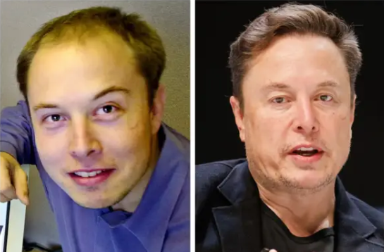 Sự khác biệt rõ rệt của Elon Musk. Ảnh: Business Insider.