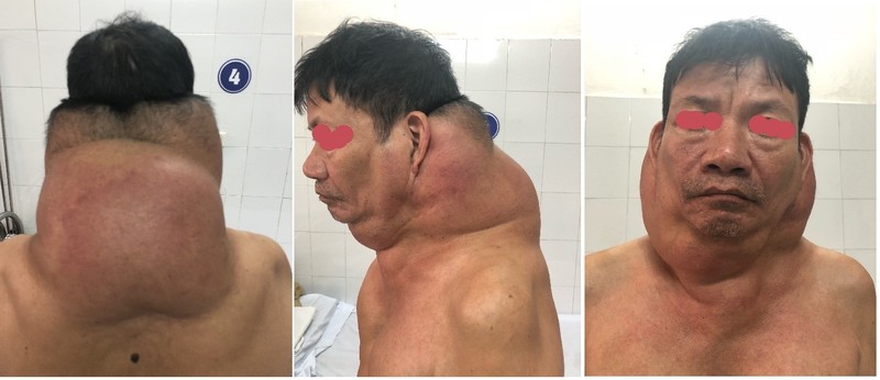 Bệnh nhân trước khi mổ