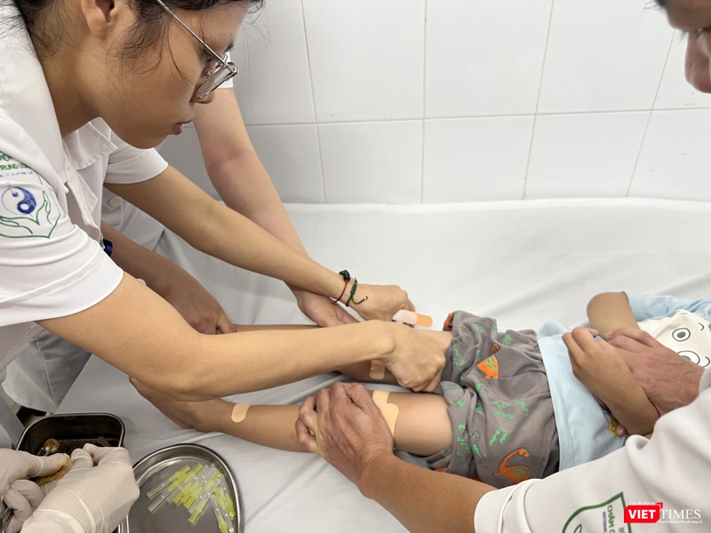 Phương pháp cấy chỉ được thực hiện phối hợp trong điều trị bại não VT_cấy chỉ.JPG