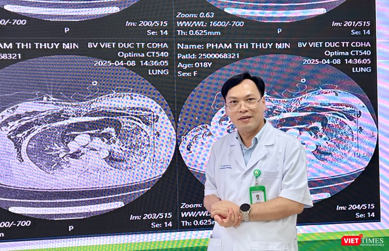 PGS.TS Phạm Hữu Lư chia sẻ với Viettimes về ca mổ kỳ tích VT_ Lư.JPG