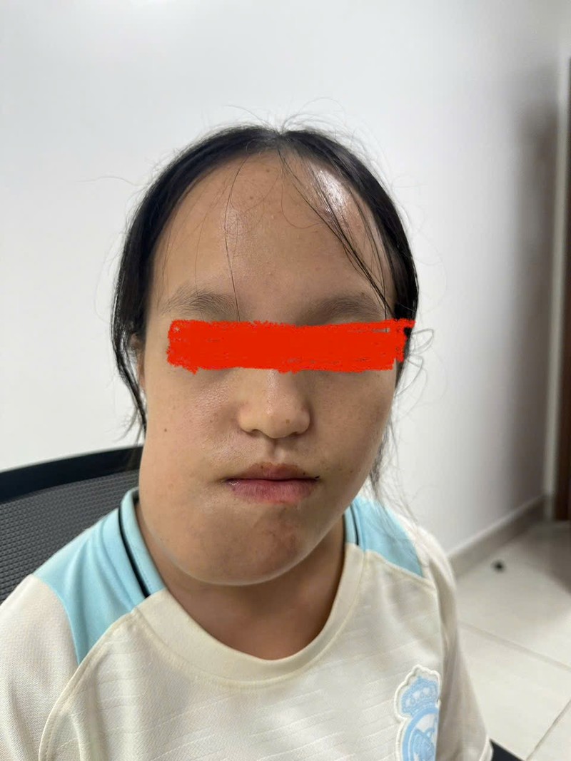 Em T. khi chưa mổ IMG_8970.jpeg