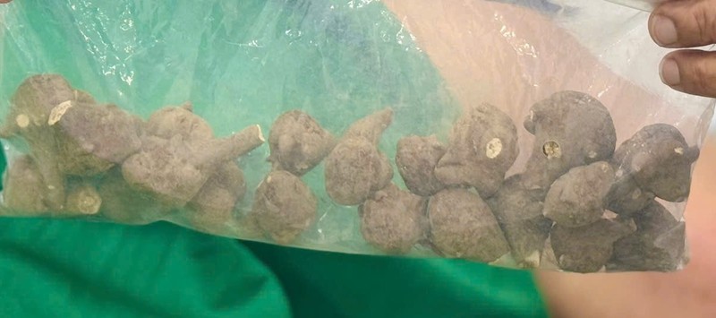 Củ ấu tầu mà bệnh nhân đã đặt mua qua mạng. z7166546694699_8819e46b7a9d61a4006f3fb0eafa56fd.jpg