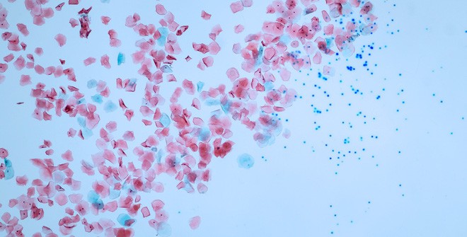 Các hạt vi nhựa có thể xâm nhập vào cơ thể người Các hạt vi nhựa có thể xâm nhập vào cơ thể người