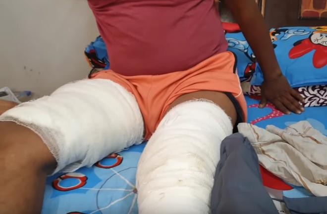 Chủ nhân của chiếc điện thoại bị thương ở chân do vụ nổ. Chủ nhân của chiếc điện thoại bị thương ở chân do vụ nổ.