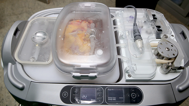 Máy bảo quản thận liên tục có hạ nhiệt (Hypothermic Machine Perfusion – HMP – LifePort Kidney Transporter). ghep tang 3.png