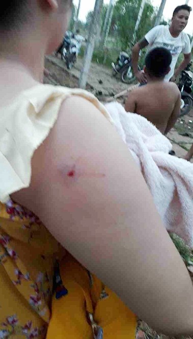 Nạn nhân trong vụ việc. Nạn nhân trong vụ việc.