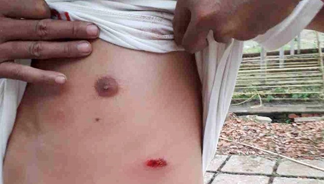 Giang hồ ngang nhiên dùng súng truy sát dân ở Củ Chi. Giang hồ ngang nhiên dùng súng truy sát dân ở Củ Chi.