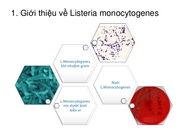 Táo Mỹ gây tử vong đã nhập khẩu vào Việt Nam ảnh 2 Táo Mỹ gây tử vong đã nhập khẩu vào Việt Nam ảnh 2
