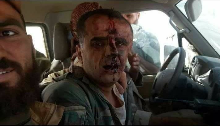 Phiến quân tuyên bố bắn hạ máy bay chiến đấu Syria, phi công bị bắt ảnh 2 Phiến quân tuyên bố bắn hạ máy bay chiến đấu Syria, phi công bị bắt ảnh 2