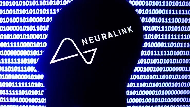 Liên doanh y tế Neuralink. Ảnh CNBC