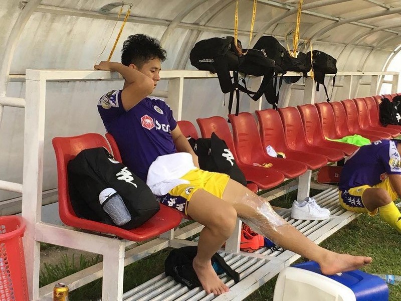 Nhiều khả năng Đình Trọng bị giãn dây chằng đầu gối không thể tham dự King’s Cup (ảnh nhân vật cung cấp) Nhiều khả năng Đình Trọng bị giãn dây chằng đầu gối không thể tham dự King’s Cup (ảnh nhân vật cung cấp)