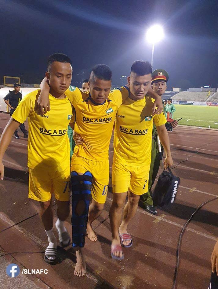 Cao Xuân Thắng chấn thương khá nặng. Ảnh SLFC