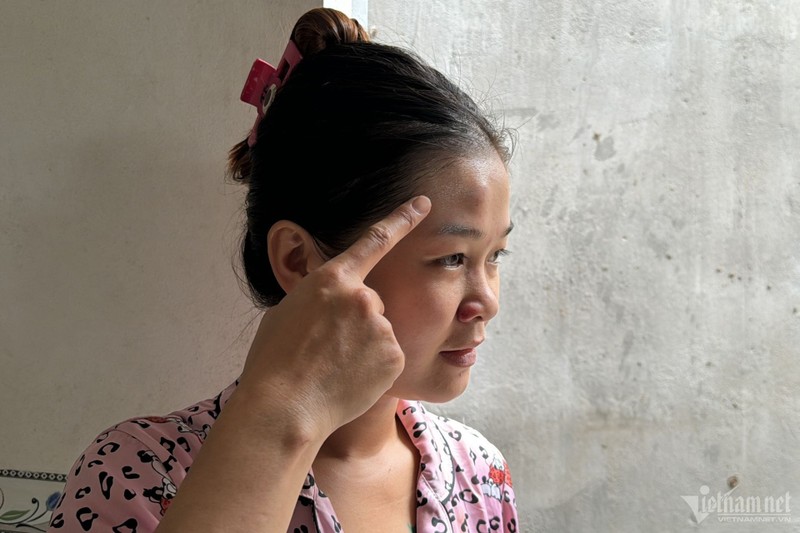 Chị Cao Thị Mỹ Loan bị thương nhẹ do trần nhà bi hư hại rơi trúng đầu 4.jpg