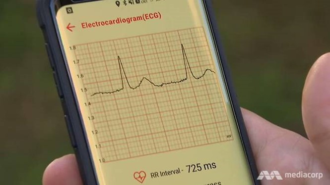 Singapore có áo thun thông minh đo được ECG của vận động viên ảnh 3 Singapore có áo thun thông minh đo được ECG của vận động viên - ảnh 3