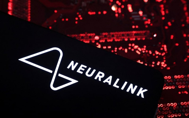 Ảnh minh họa: Reuters neuralink - Reuters.jpg