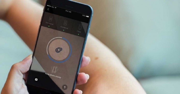 Ảnh minh họa (SkinVision)