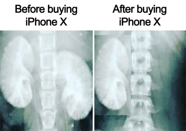 Cười đau ruột với những tấm ảnh chế iPhone X ảnh 1 Cười đau ruột với những tấm ảnh chế iPhone X ảnh 1
