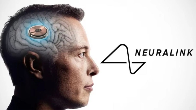 Neuralink cấy ghép chip não thành công cho bệnh nhân đầu tiên