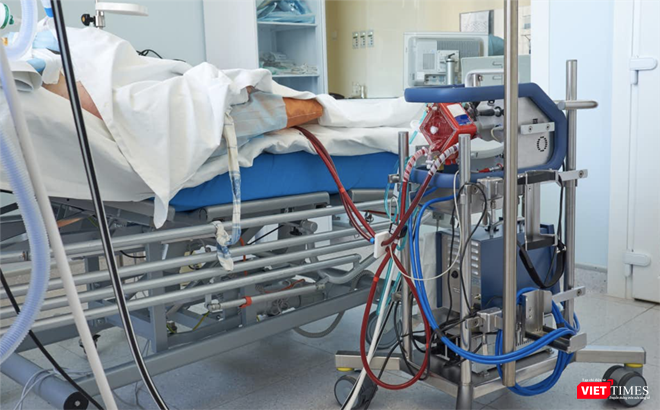Kỹ thuật ECMO (Ảnh: SYT) Kỹ thuật ECMO (Ảnh: SYT)